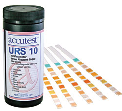 Urinalysis Urinalysis